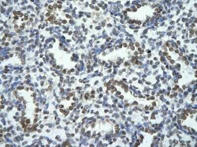 Immunohistochemistry-Paraffin: TRIOBP Antibody [NBP2-88482]