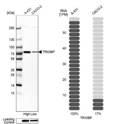 Western Blot: TRIOBP Antibody [NBP1-90589]