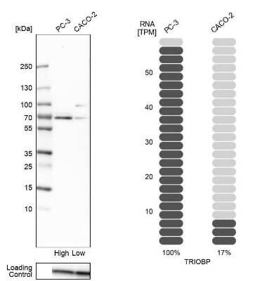 Western Blot: TRIOBP Antibody [NBP1-90590]