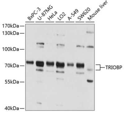 Western Blot: TRIOBP AntibodyBSA Free [NBP2-93144]