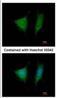 Immunocytochemistry/ Immunofluorescence: TRIP1 Antibody [NBP2-16300]