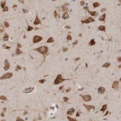 Immunohistochemistry-Paraffin: TRIP1 Antibody [NBP1-84874]
