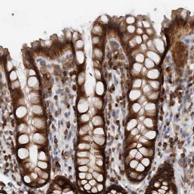 Immunohistochemistry-Paraffin: TRIP1 Antibody [NBP1-84874]