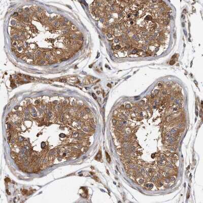 Immunohistochemistry-Paraffin: TRIP1 Antibody [NBP1-84874]