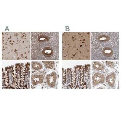 Immunohistochemistry-Paraffin: TRIP1 Antibody [NBP1-84874]
