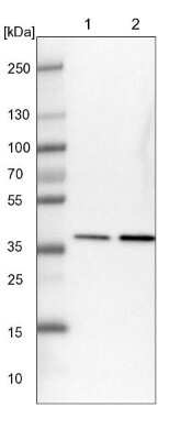 Western Blot: TRIP1 Antibody [NBP1-84874]