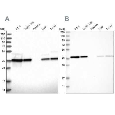 Western Blot: TRIP1 Antibody [NBP1-84874]