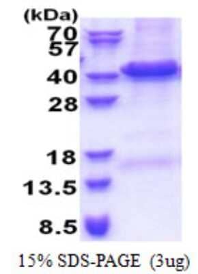 SDS-PAGE: Recombinant Human TRIP1 His Protein [NBP2-23031]