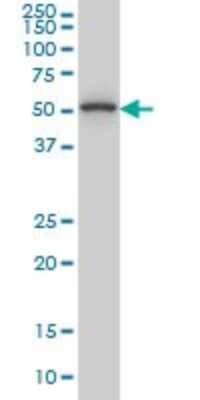 Western Blot: TRIP6 Antibody (4B7) [H00007205-M04]