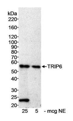 Western Blot: TRIP6 Antibody [NB100-79791]