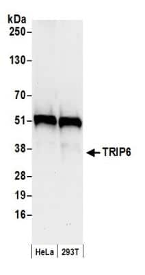 Western Blot: TRIP6 Antibody [NB100-79791]