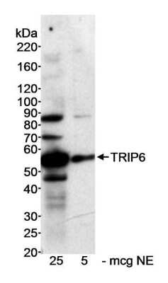 Western Blot: TRIP6 Antibody [NB100-79792]