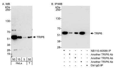 Western Blot: TRIP6 Antibody [NB110-40589]