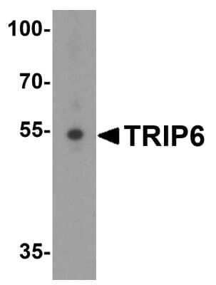 Western Blot: TRIP6 AntibodyBSA Free [NBP1-76305]