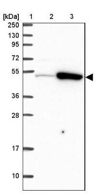 Western Blot: TRIP6 Antibody [NBP2-33667]