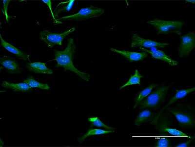 Immunocytochemistry/ Immunofluorescence: TRIT1 Antibody [H00054802-B01P]