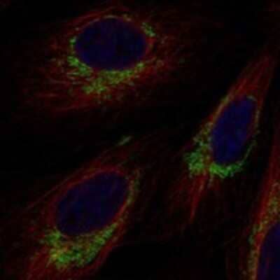 Immunocytochemistry/ Immunofluorescence: TRIT1 Antibody [NBP3-17951]