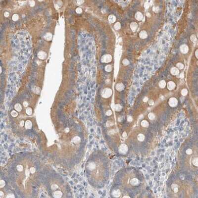 Immunohistochemistry-Paraffin: TRIT1 Antibody [NBP1-82210]