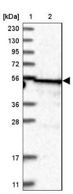 Western Blot: TRIT1 Antibody [NBP1-82210]