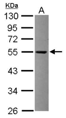 Western Blot: TRIT1 Antibody [NBP2-20727]