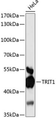 Western Blot: TRIT1 AntibodyAzide and BSA Free [NBP2-94305]