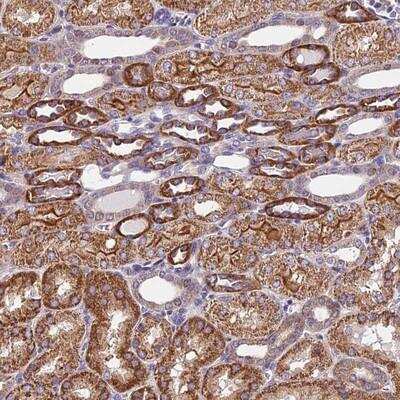 Immunohistochemistry-Paraffin: TRM1 Antibody [NBP1-82198]