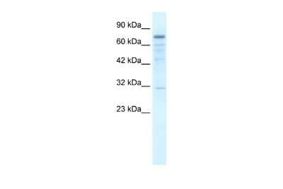 Western Blot: TRM1 Antibody [NBP2-86002]