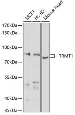 Western Blot: TRM1 AntibodyBSA Free [NBP2-93001]