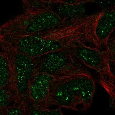 Immunocytochemistry/ Immunofluorescence: TRM11 Antibody [NBP2-57607]