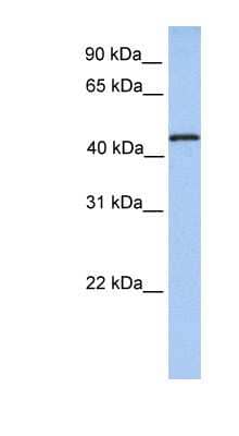 Western Blot: TRM11 Antibody [NBP1-52998]