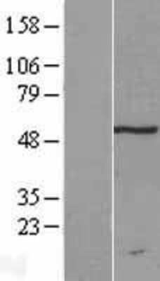 Western Blot: TRM11 Overexpression Lysate [NBL1-17322]