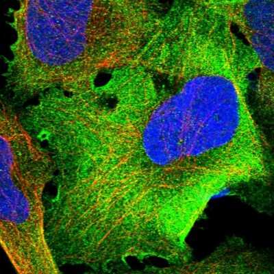 Immunocytochemistry/ Immunofluorescence: TRM1 Antibody [NBP1-82197]