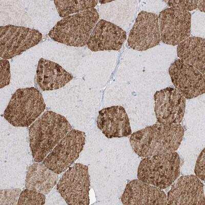 Immunohistochemistry: TRMU Antibody [NBP1-87923]