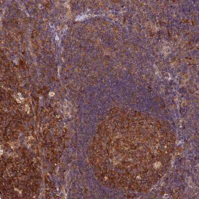 Immunohistochemistry-Paraffin: TRM1 Antibody [NBP1-82197]