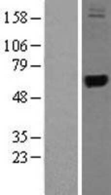 Western Blot: TRMU Overexpression Lysate [NBL1-17326]