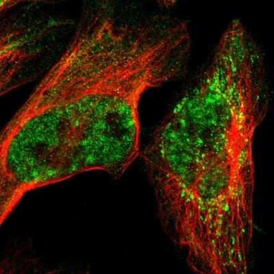 Immunocytochemistry/ Immunofluorescence: TRMT12 Antibody [NBP1-83633]