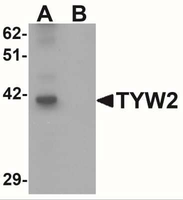 Western Blot: TRMT12 AntibodyBSA Free [NBP1-76583]