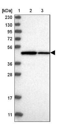 Western Blot: TRMT12 Antibody [NBP1-83633]