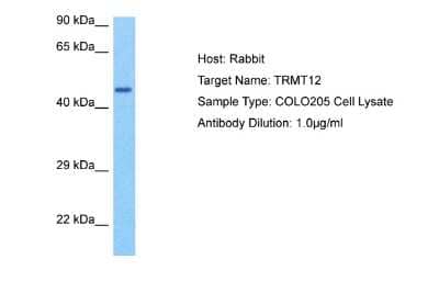 Western Blot: TRMT12 Antibody [NBP2-88484]