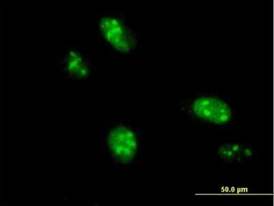 Immunocytochemistry/ Immunofluorescence: TRMT1L Antibody [H00081627-B01P]