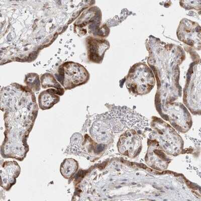 Immunohistochemistry-Paraffin: TRMT1L Antibody [NBP1-88337]