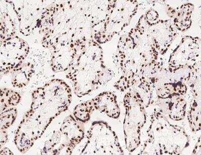 Immunohistochemistry-Paraffin: TRMT1L Antibody [NBP3-12621]