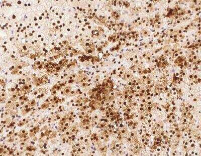 Immunohistochemistry-Paraffin: TRMT1L Antibody [NBP3-12621]