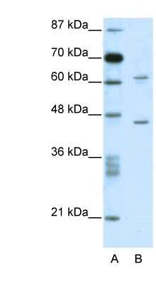 Western Blot: TRMT1L Antibody [NBP1-79968]