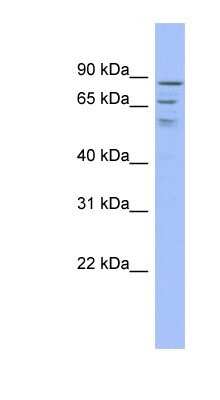 Western Blot: TRMT1L Antibody [NBP1-80371]