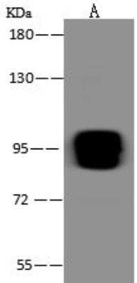 Western Blot: TRMT1L Antibody [NBP3-12621]