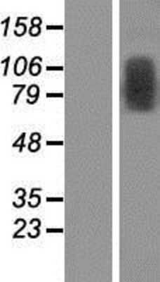 Western Blot: TRMT1L Overexpression Lysate [NBP2-06159]