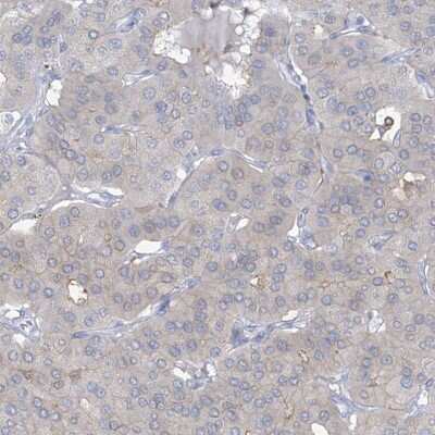 Immunohistochemistry-Paraffin: TRMT2B Antibody [NBP1-85370]