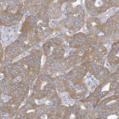 Immunohistochemistry-Paraffin: TRMT2B Antibody [NBP2-38123]