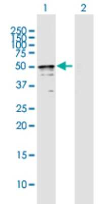 Western Blot: TRMT2B Antibody [H00079979-B02P]